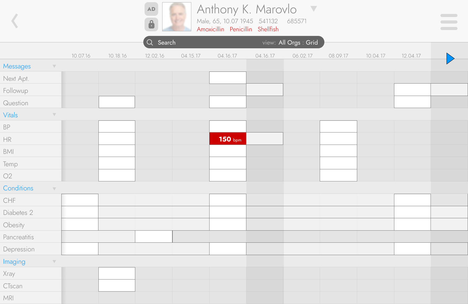 The redesigned patient summary: a flat grid of messages, vitals, conditions and imaging across a row of dates, with one abnormal heart rate called out in red.